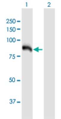 Western Blot: Hexokinase Type III Antibody [H00003101-B01P]