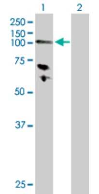 Western Blot: Hexokinase Type III Antibody [H00003101-D01P]