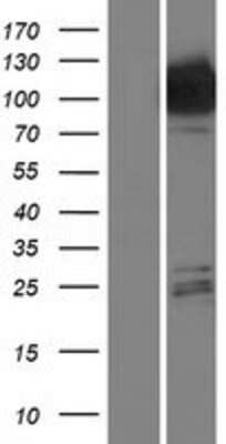 Western Blot: Hexokinase Type III Overexpression Lysate [NBP2-10803]