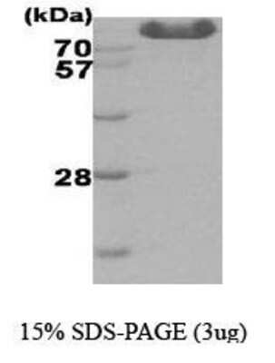 SDS-PAGE: Recombinant Human Hexokinase Type III His Protein [NBC1-18387]