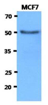 Western Blot: Hexosaminidase A/HEXA Antibody (20F1)BSA Free [NBP2-42629]