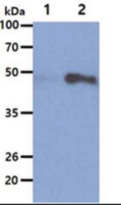 Western Blot: Hexosaminidase A/HEXA Antibody (20F1)BSA Free [NBP2-42629]