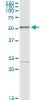 Western Blot: Hexosaminidase A/HEXA Antibody (3D1) [H00003073-M06]