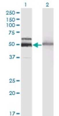 Western Blot: Hexosaminidase A/HEXA Antibody (3D1) [H00003073-M06]