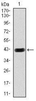Western Blot: Hexosaminidase A/HEXA Antibody (3F10)BSA Free [NBP2-37505]