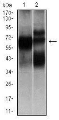 Western Blot: Hexosaminidase A/HEXA Antibody (3F10)BSA Free [NBP2-37505]