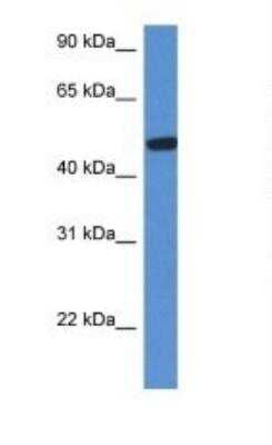 Western Blot: Hexosaminidase A/HEXA Antibody [NBP1-74127]