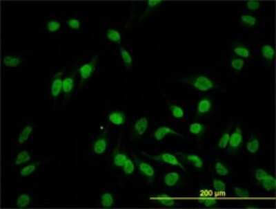 Immunocytochemistry/ Immunofluorescence: Hey L Antibody (1F6) [H00026508-M07]