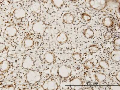 Immunohistochemistry-Paraffin: Hey L Antibody (1F6) [H00026508-M07]