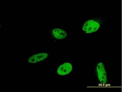 Immunocytochemistry/ Immunofluorescence: Hey L Antibody (2G1) [H00026508-M03]