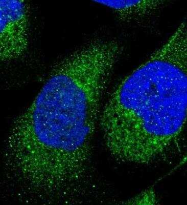 Immunocytochemistry/ Immunofluorescence: Hey L Antibody [NBP1-89981]