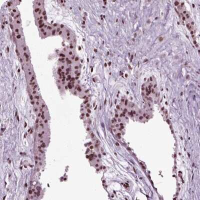 Immunohistochemistry-Paraffin: Hey L Antibody [NBP2-69029]