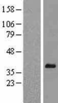 Western Blot: Hey L Overexpression Lysate [NBL1-11523]