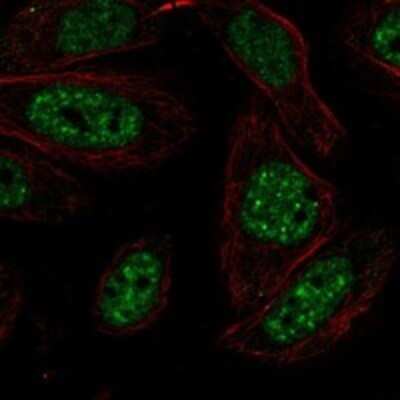 Immunocytochemistry/ Immunofluorescence: Hikeshi Antibody [NBP3-17259]