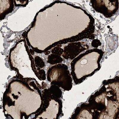 Immunohistochemistry: Hikeshi Antibody [NBP2-33986]