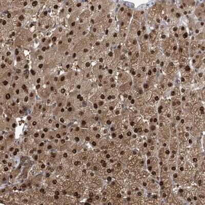 Immunohistochemistry-Paraffin: Hikeshi Antibody [NBP1-83174]