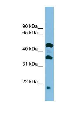 Western Blot: Hikeshi Antibody [NBP1-57764]