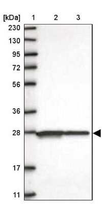 Western Blot: Hikeshi Antibody [NBP1-83174]