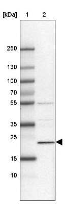 Western Blot: Hikeshi Antibody [NBP2-33986]