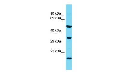 Western Blot: Hikeshi Antibody [NBP2-87566]