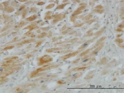 Immunohistochemistry-Paraffin: Hip Antibody (5D11) [H00064399-M01]