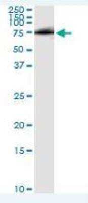 Immunoprecipitation: Hip Antibody (5D11) [H00064399-M01]