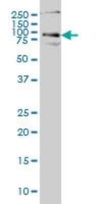 Western Blot: Hip Antibody (5D11) [H00064399-M01]