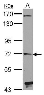 Western Blot: Hip Antibody [NBP2-16821]