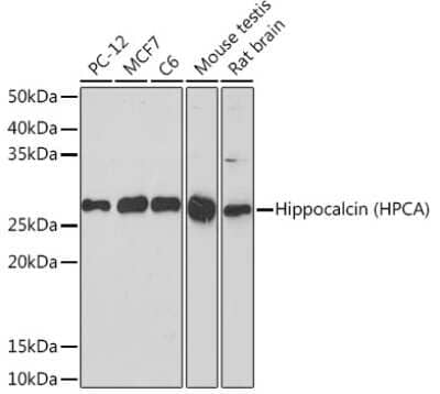 Western Blot: Hippocalcin Antibody (6N2A6) [NBP3-15864]