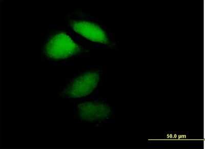 Immunocytochemistry/ Immunofluorescence: Hippocalcin Antibody [H00003208-B01P]
