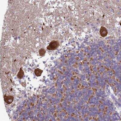 Immunohistochemistry-Paraffin: Hippocalcin Antibody [NBP2-54705]