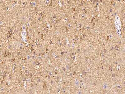 Immunohistochemistry-Paraffin: Hippocalcin Antibody [NBP3-06199]