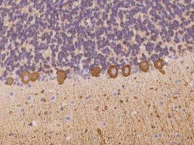 Immunohistochemistry-Paraffin: Hippocalcin Antibody [NBP3-06199]