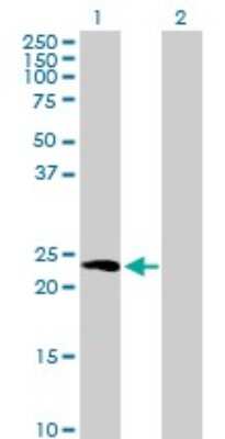 Western Blot: Hippocalcin Antibody [H00003208-B01P]