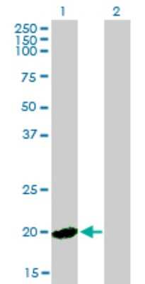 Western Blot: Hippocalcin like 4 Antibody (2B11) [H00051440-M01]