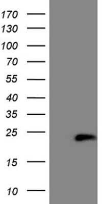 Western Blot: Hippocalcin like 4 Antibody (OTI3C3) [NBP2-46002]