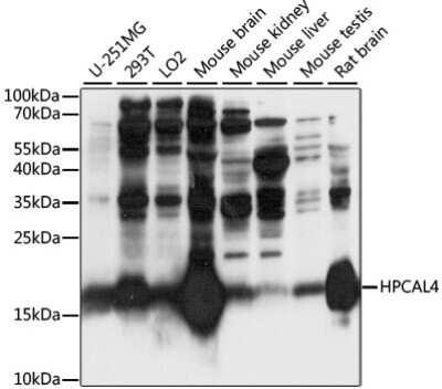 Western Blot: Hippocalcin like 4 AntibodyAzide and BSA Free [NBP3-03318]