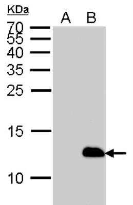 Western Blot: His Tag Antibody (359) [NBP2-43536]