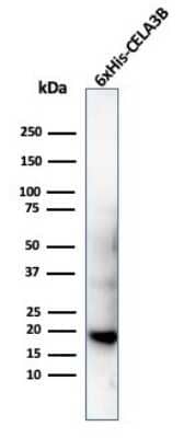 Western Blot: His Tag Antibody (6HIS/6402R)Azide and BSA Free [NBP3-08360]