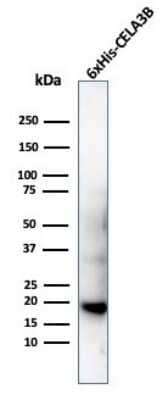 Western Blot: His Tag Antibody (6HIS/6402R) [NBP3-07271]