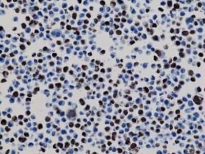 Immunohistochemistry-Paraffin: His Tag Antibody (RM146) [NBP2-61482]