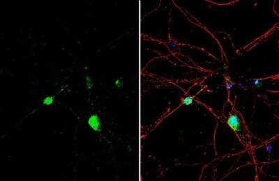 Immunocytochemistry/ Immunofluorescence: Histamine Antibody [NBP3-13403]