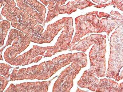 Immunohistochemistry: Histamine Antibody [NBP2-45266]