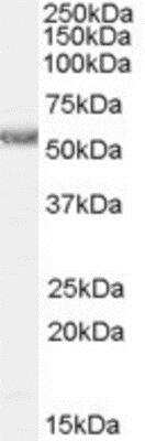 Western Blot: Histamine H1R Antibody [NBP1-06039]