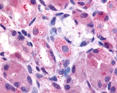 Immunohistochemistry-Paraffin: Histamine H2R Antibody - BSA Free [NLS1176]