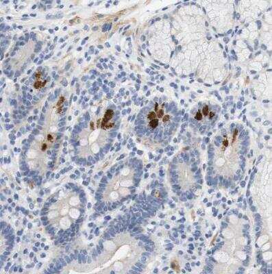 Immunohistochemistry-Paraffin: Histamine H2R Antibody [NBP1-86082]