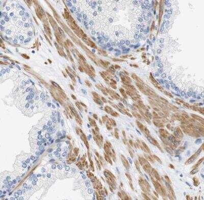 Immunohistochemistry-Paraffin: Histamine H2R Antibody [NBP1-86082]