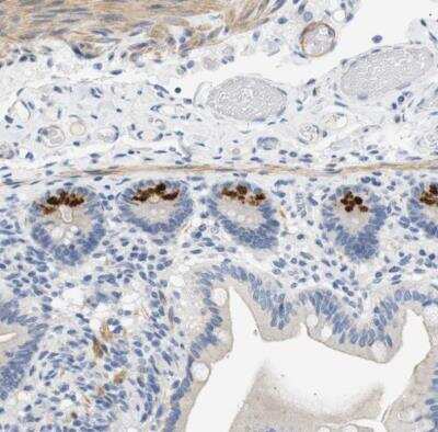 Immunohistochemistry-Paraffin: Histamine H2R Antibody [NBP1-86082]