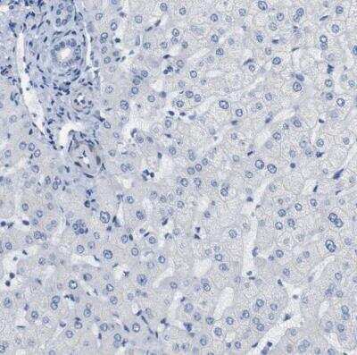 Immunohistochemistry-Paraffin: Histamine H2R Antibody [NBP1-86082]