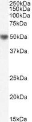 Western Blot: Histamine H2R Antibody [NB600-812]